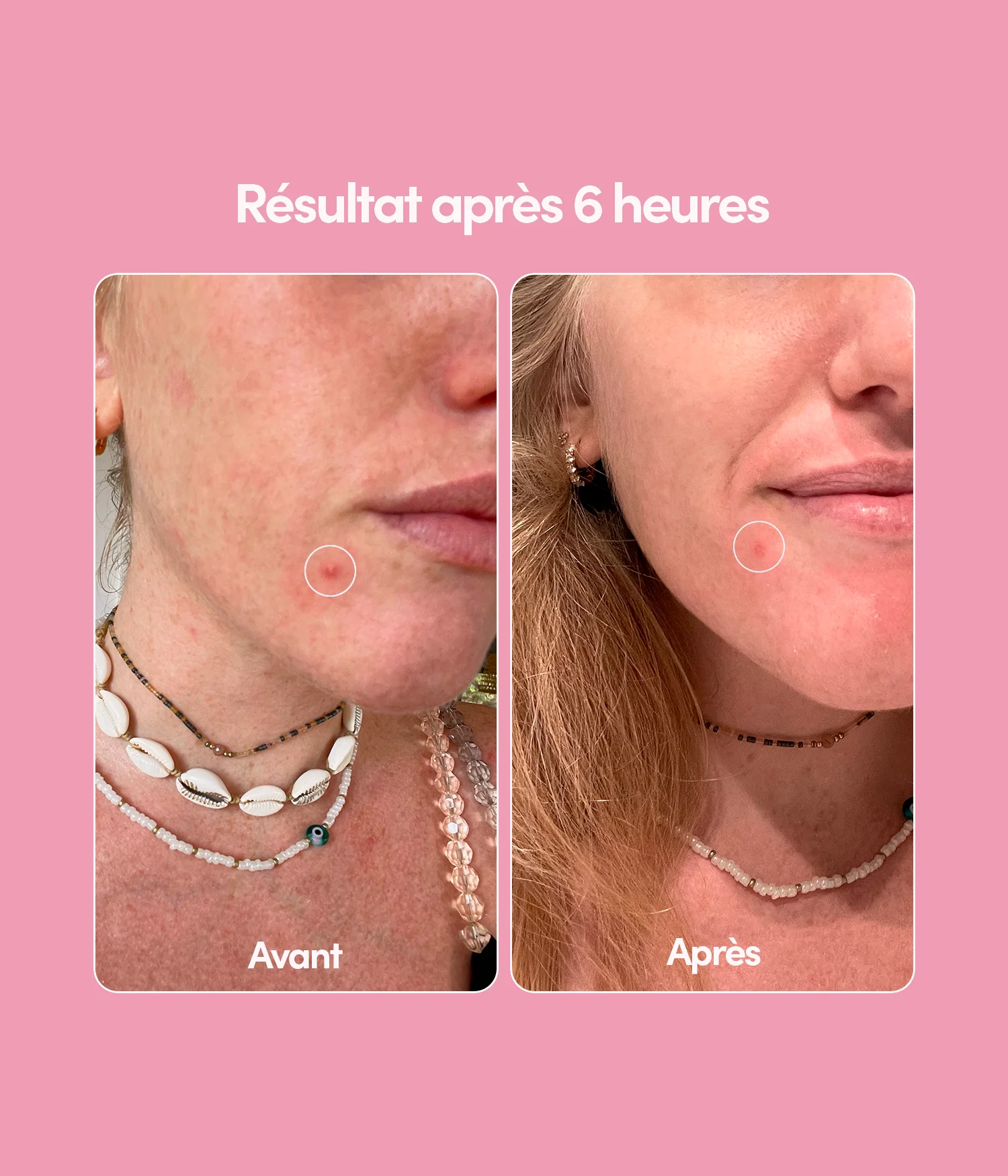 24 Patchs Boutons Unicorn Edition - Image 7