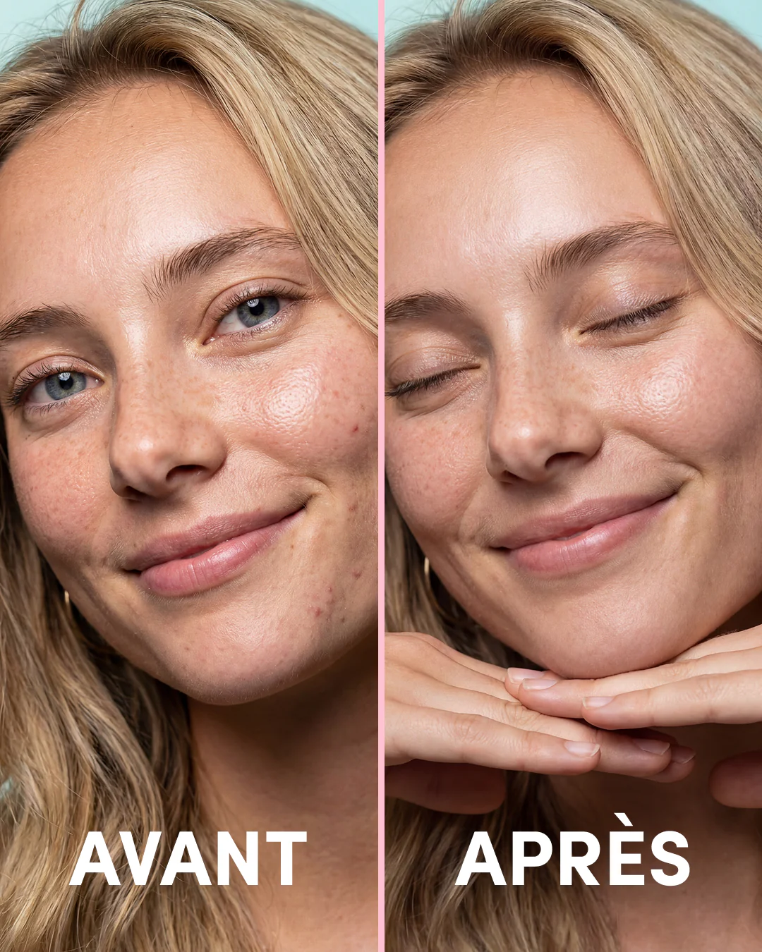 DUO Patchs Nez + Boutons Holo - Image 9